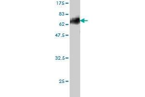 Western Blot detection against Immunogen (57. (DLX3 抗体  (AA 1-287))