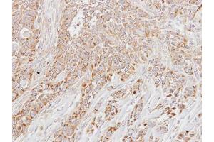 IHC-P Image Immunohistochemical analysis of paraffin-embedded HSC3 xenograft, using LETM1, antibody at 1:500 dilution.