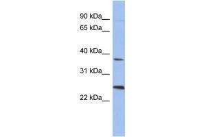 WB Suggested Anti-MAGEB2 Antibody Titration: 0. (MAGEB2 抗体  (N-Term))