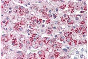 Adrenal, Human: Formalin-Fixed, Paraffin-Embedded (FFPE) (NTSR2 抗体  (Internal Region))