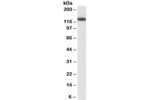 Western blot testing of NIH3T3 lysate with MYO1B antibody at 1ug/ml. (Myosin IB 抗体)