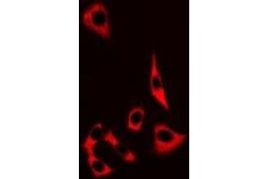 Immunofluorescent analysis of MRP8 staining in MCF7 cells. (S100A8 抗体)