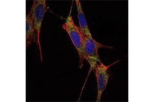 Immunofluorescence analysis of NIH/3T3 cells using SMAD4 mouse mAb (green). (SMAD4 抗体)