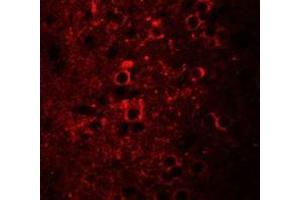 Immunofluorescence of CCDC55 in mouse brain cells with CCDC55 antibody at 20 ug/mL. (NSRP1 抗体  (C-Term))