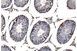 IHC analysis of RRS1 using anti-RRS1 antibody (ABIN7601344). (RRS1 抗体  (AA 33-266))
