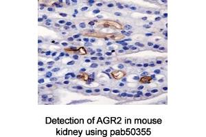 Image no. 3 for anti-Anterior Gradient Homolog 2 (Xenopus Laevis) (AGR2) (AA 50-100) antibody (ABIN363664) (AGR2 抗体  (AA 50-100))