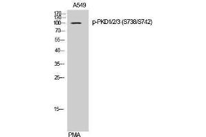 Western Blotting (WB) image for anti-Polycystic Kidney Disease 1/2/3 (PKD1/2/3) (pSer738), (pSer742) antibody (ABIN3182590) (PKD1/2/3 抗体  (pSer738, pSer742))