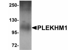 Image no. 1 for anti-Pleckstrin Homology Domain Containing, Family M (With RUN Domain) Member 1 (PLEKHM1) (N-Term) antibody (ABIN478196)