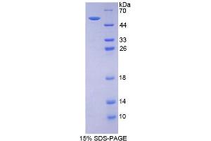 SDS-PAGE analysis of Mouse Estrogen Receptor 2 Protein. (ESR2 蛋白)