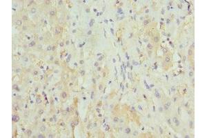 Immunohistochemistry of paraffin-embedded human liver tissue using ABIN7155891 at dilution of 1:100 (HGD 抗体  (AA 226-445))