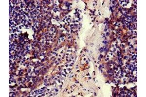 Immunohistochemistry of paraffin-embedded human tonsil tissue using ABIN7159312 at dilution of 1:100 (MFI2 抗体  (AA 20-302))