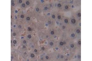 IHC-P analysis of Rat Tissue, with DAB staining. (GALT 抗体  (AA 1-379))