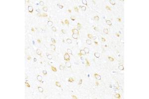 Immunohistochemistry of paraffin-embedded rat brain using DDX3Y antibody (ABIN6130260, ABIN6139496, ABIN6139497 and ABIN6215395) at dilution of 1:100 (40x lens). (DDX3Y 抗体  (AA 1-210))