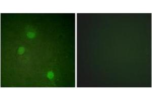 Immunofluorescence analysis of HeLa cells, using AurB (Ab-232) Antibody. (Aurora Kinase B 抗体  (AA 198-247))