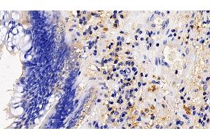 Immunohistochemistry (IHC) image for anti-Transmembrane Protease, serine 2 (TMPRSS2) (AA 284-492) antibody (ABIN7435142)