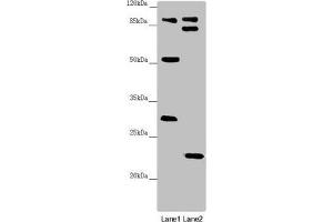 Western blot All lanes: KANSL3 antibody at 1. (KANSL3 抗体  (AA 1-200))
