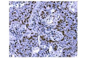 IHC analysis of Ki67 using anti-Ki67 antibody (ABIN7601101).