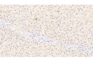 Detection of ADIPOR2 in Human Liver Tissue using Polyclonal Antibody to Adiponectin Receptor 2 (ADIPOR2) (Adiponectin Receptor 2 抗体  (AA 2-155))
