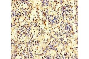Immunohistochemistry of paraffin-embedded human spleen tissue using ABIN7176159 at dilution of 1:100 (ZNF221 抗体  (AA 1-300))