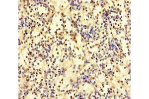 Immunohistochemistry of paraffin-embedded human spleen tissue using ABIN7176159 at dilution of 1:100 (ZNF221 抗体  (AA 1-300))