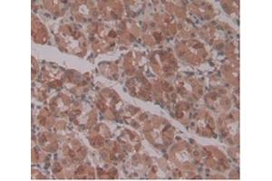 DAB staining on IHC-P Samples:Human Stomach Tissue. (ENPP2 抗体  (AA 637-905))
