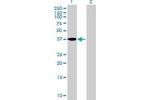 Western Blot analysis of FST expression in transfected 293T cell line by FST MaxPab polyclonal antibody. (Follistatin 抗体  (AA 1-344))