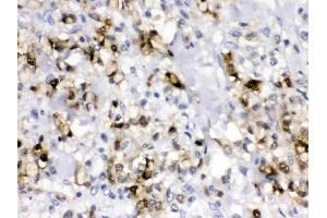 IHC analysis of CA2 using anti- CA2 antibody . (CA2 抗体  (AA 2-260))