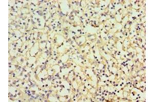 Immunohistochemistry of paraffin-embedded human spleen tissue using ABIN7146745 at dilution of 1:100 (CBR3 抗体  (AA 118-277))