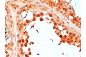 ABIN2560635 (2µg/ml) staining of paraffin embedded Human Testis. (UBE2R2 抗体  (N-Term))