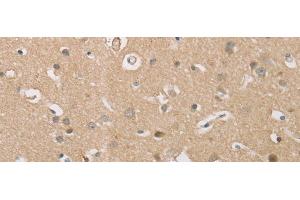 Immunohistochemistry of paraffin-embedded Human brain tissue using P2RY11 Polyclonal Antibody at dilution of 1:30(x200) (P2RY11 抗体)