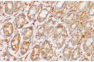 Immunohistochemistry of paraffin-embedded Rat colon using HRAS Polycloanl Antibody at dilution of 1:200 (HRAS 抗体)