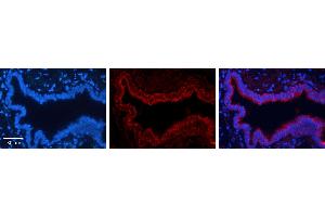 TKT antibody - N-terminal region          Formalin Fixed Paraffin Embedded Tissue:  Human Bronchial Epithelial Tissue    Observed Staining:  Cytoplasm of bronchial epithelial tissue   Primary Antibody Concentration:  1:100    Secondary Antibody:  Donkey anti-Rabbit-Cy3    Secondary Antibody Concentration:  1:200    Magnification:  20X    Exposure Time:  0. (TKT 抗体  (N-Term))