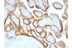 Formalin-fixed, paraffin-embedded human placenta stained with hCG beta antibody (HCGb/54 + HCGb/459). (HCG beta 抗体)
