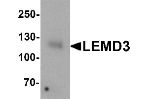 Western blot analysis of LEMD3 in human colon tissue lysate with LEMD3 antibody at 1 µg/mL. (LEMD3 抗体  (C-Term))
