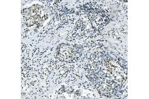 IHC analysis of PRDM5 using anti-PRDM5 antibody (ABIN7600853). (PRDM5 抗体  (AA 24-630))