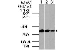 Image no. 1 for anti-PDZ and LIM Domain 1 (PDLIM1) (AA 116-329) antibody (ABIN5027118) (PDLIM1 抗体  (AA 116-329))