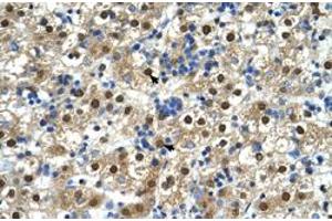 Immunohistochemical staining (Formalin-fixed paraffin-embedded sections) of human liver with GDE1 polyclonal antibody  at 4-8 ug/mL working concentration. (GDE1 抗体  (N-Term))