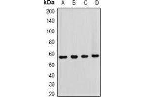 Western blot analysis of HOS expression in Hela (A), NIH3T3 (B), mouse brain (C), rat brain (D) whole cell lysates.