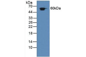 Figure. (HSPD1 抗体  (AA 172-343))