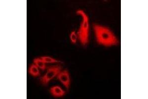 Immunofluorescent analysis of NFS1 staining in Hela cells. (NFS1 抗体)