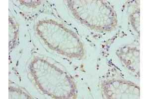 Immunohistochemistry (IHC) image for anti-Solute Carrier Family 1 (High Affinity Aspartate/glutamate Transporter), Member 6 (SLC1A6) (AA 149-271) antibody (ABIN7152238)