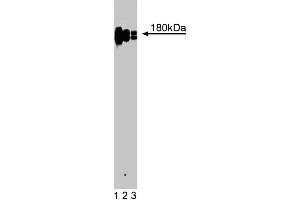 Western blot analysis of CD11a (Integrin alphaL) on a Jurkat cell lysate (Human T-cell leukemia, ATCC TIB-152). (ITGAL 抗体  (AA 64-199))