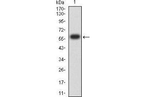 Western blot analysis using KDM1A mAb against human KDM1A (AA: 55-263) recombinant protein. (LSD1 抗体  (AA 55-263))