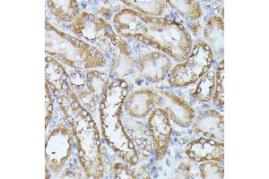 Immunohistochemistry of paraffin-embedded rat kidney using HAL antibody (ABIN6130467, ABIN6141593, ABIN6141594 and ABIN6216851) at dilution of 1:100 (40x lens).