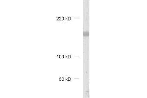 dilution: 1 : 1000, sample: rat brain homogenate (PRKRIR 抗体)