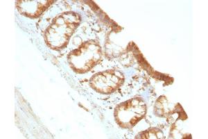 Immunohistochemistry (IHC) image for anti-Moesin (MSN) antibody (ABIN6940082)