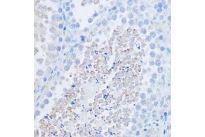 Immunohistochemistry of paraffin-embedded mouse testis using RALGDS antibody (ABIN7269838) at dilution of 1:100 (40x lens). (RALGDS 抗体)