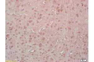 Formalin-fixed and paraffin embedded rat brain labeled with Rabbit Anti Phospho-MEF2A (Thr312) Polyclonal Antibody, Unconjugated (ABIN743768) at 1:200 followed by conjugation to the secondary antibody and DAB staining