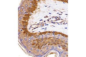 (ABIN6242624 and ABIN6577142) staining S100A2 in human skin tissue sections by Immunohistochemistry (IHC-P - paraformaldehyde-fixed, paraffin-embedded sections). (S100A2 抗体)