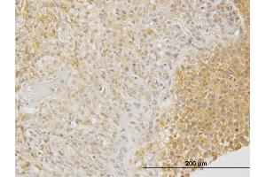 Immunoperoxidase of monoclonal antibody to DPYSL3 on formalin-fixed paraffin-embedded human ovary. (DPYSL3 抗体  (AA 457-555))